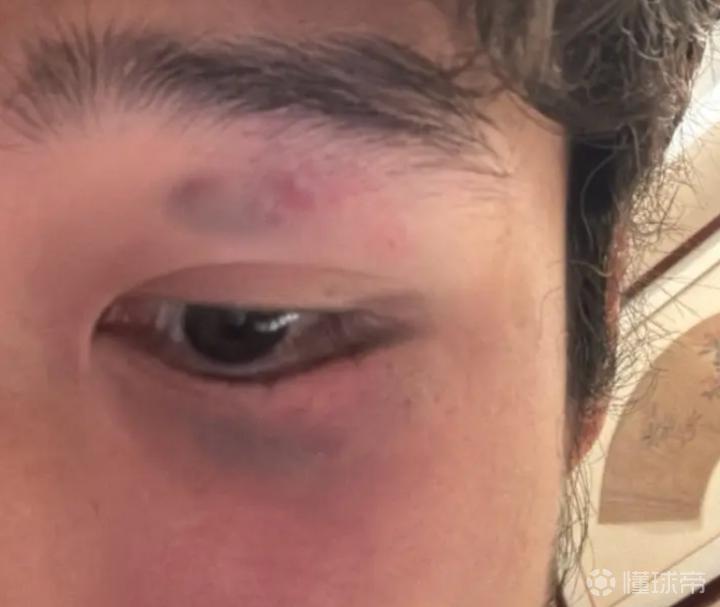 《定位球攻防:人墙防守的技术细节与意外风险》 体育新闻