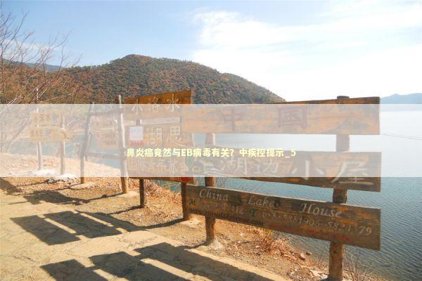 鼻炎癌竟然与EB病毒有关？中疾控提示_5 新闻